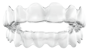 Aligners